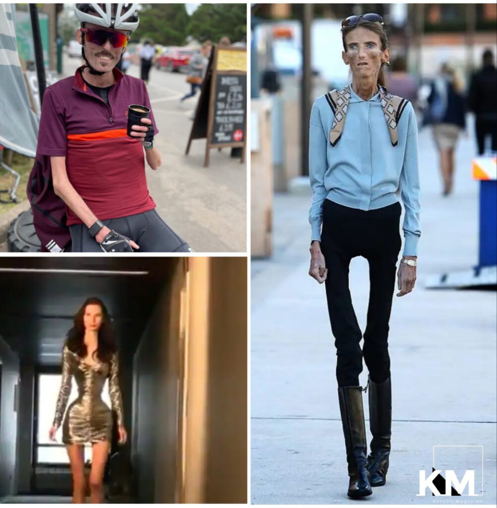 Top 10 Skinniest People In The World 2022 Kenyan Magazine   IMG 20210819 123558 272 1002x1024 