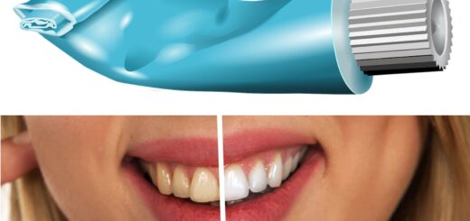 Best Toothpastes for teeth whitening