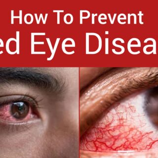 Red eye disease prevention