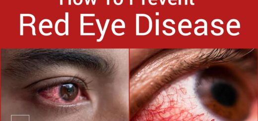 Red eye disease prevention